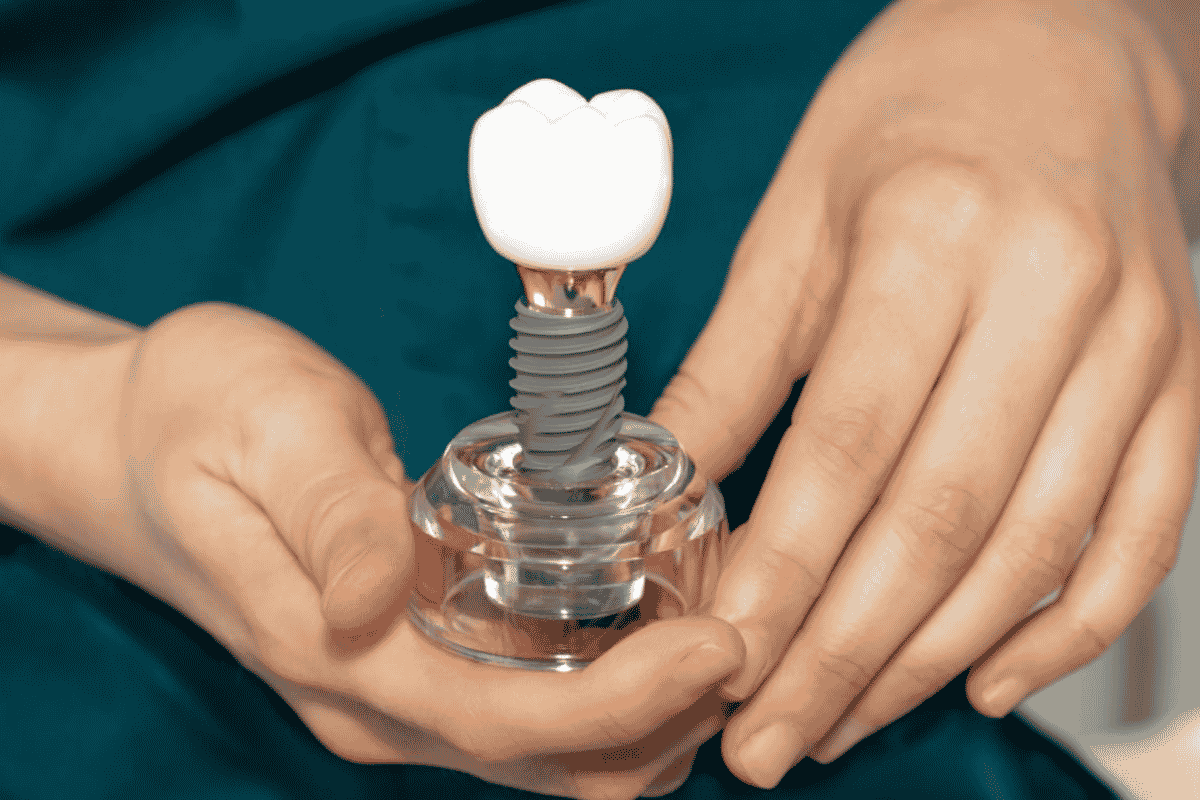 Dental Implants Years After Losing a Tooth Dental Implants Years After Losing a Tooth
